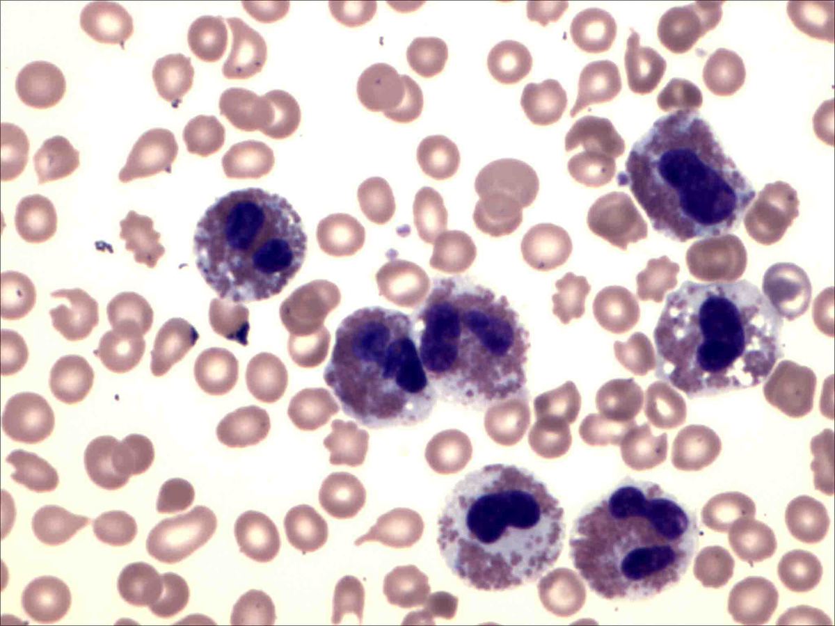 Peripheral blood smear, 60X